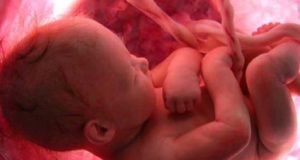 Científicos de Alberta podrían haber descubierto un método para detectar muerte fetal