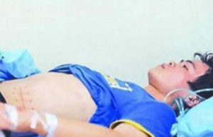 Vendió su riñón por un iPhone y ahora estará en diálisis toda su vida