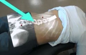 Investigadores de Alberta combinan rayos X y realidad virtual para nuevos tratamientos médicos