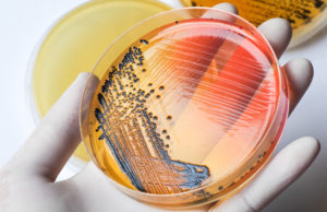 Investigan brote de salmonella en 6 provincias canadienses